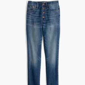 Madewell Button Fly High-Rise Vintage Jeans